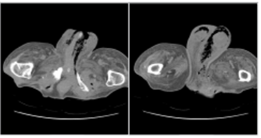 전공의핸드북 그림59.png