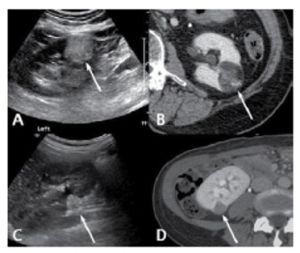 신장 및 방광 10.jpg