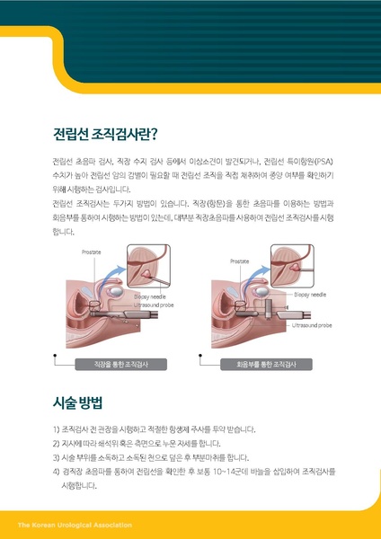 파일:전립선 조직검사.pdf
