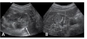 신장 및 방광 9.jpg