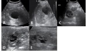 신장 및 방광 8.jpg