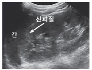 신장 및 방광 6.jpg