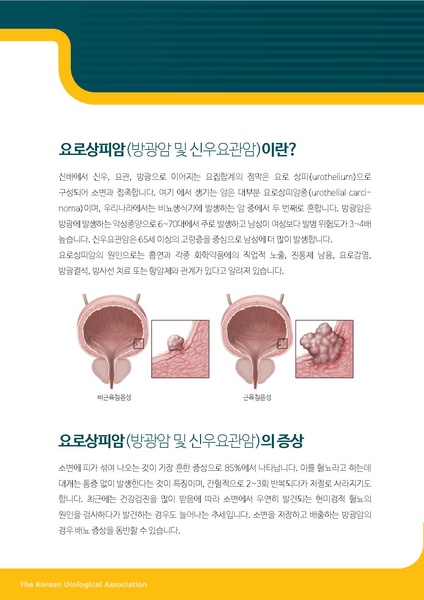 파일:방광암 및 신우요관암.pdf