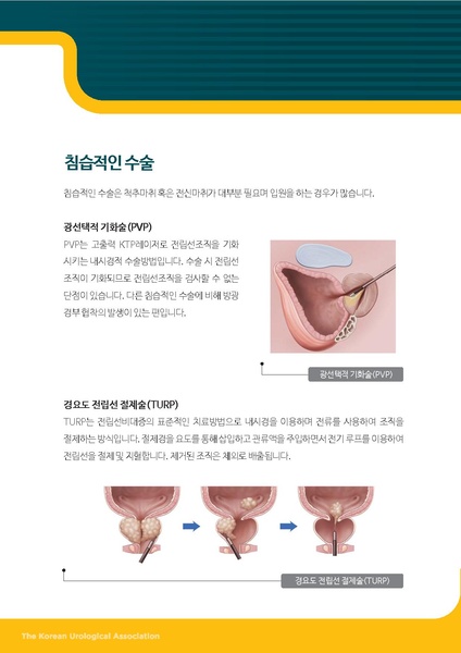 파일:Test 전립.pdf