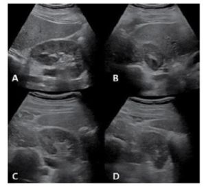 신장 및 방광 1.jpg