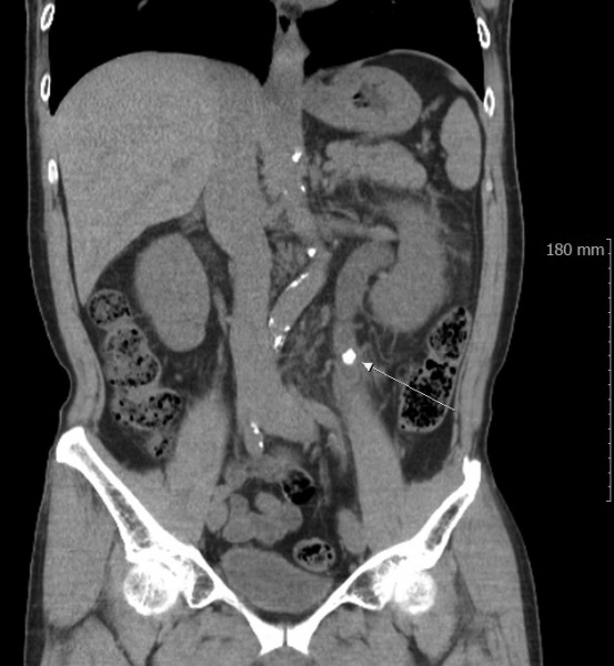 파일:실습학생지침서 그림84.JPG