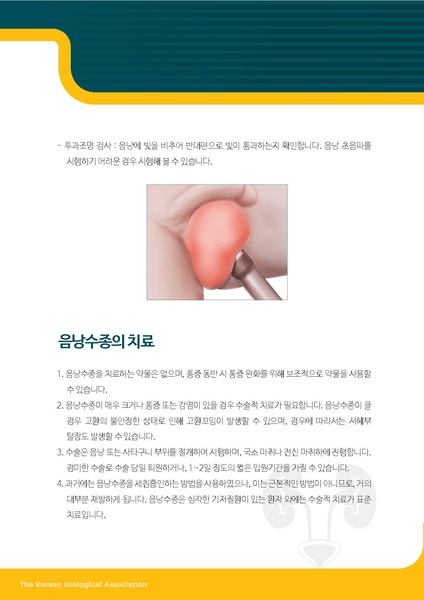 파일:성인 음낭수종.pdf