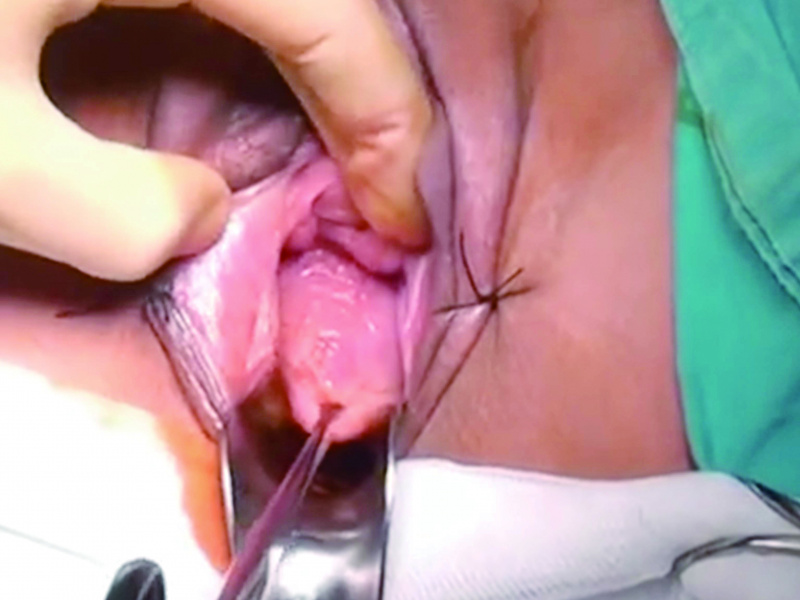 파일:실습학생지침서 그림44.jpg