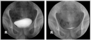전공의핸드북 그림47.png