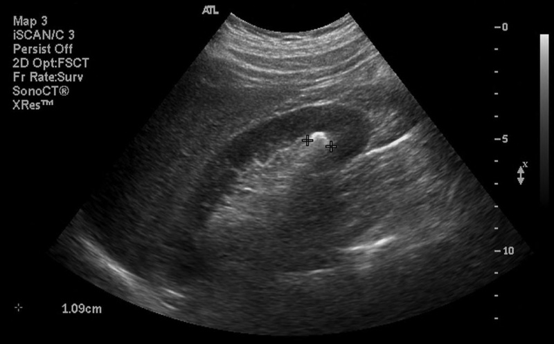 파일:실습학생지침서 그림85.JPG