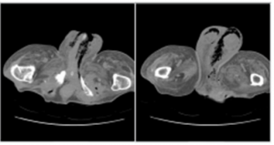 전공의핸드북 그림59.png