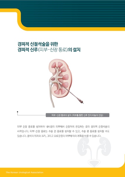 파일:PCNL.pdf
