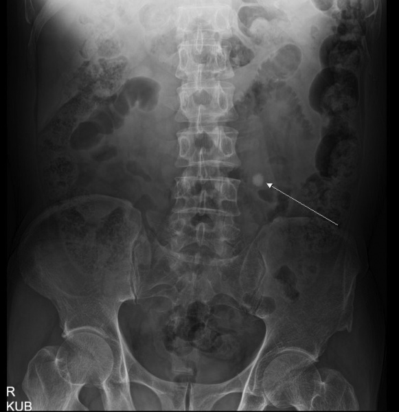 파일:실습학생지침서 그림80.JPG