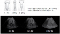 초음파 검사 장비의 기본구조 9.jpg