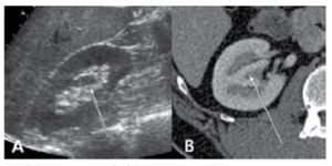 신장 및 방광 3.jpg