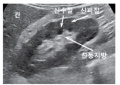 신장 및 방광 2.jpg