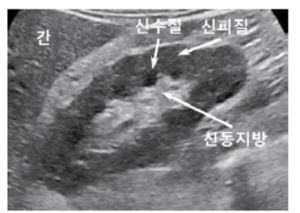 신장 및 방광 2.jpg