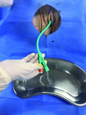 실습학생지침서 그림35.jpg