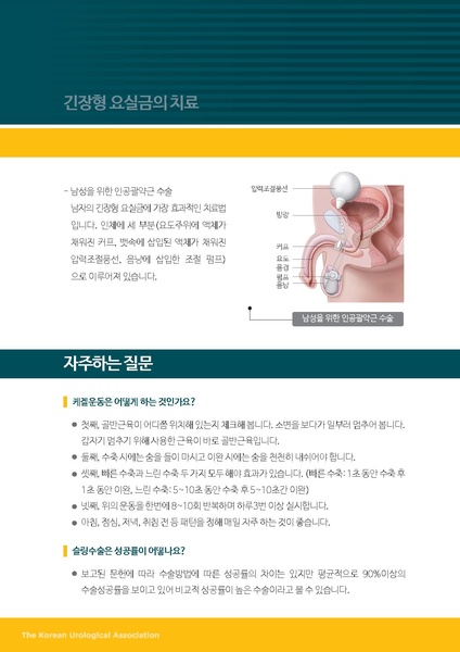 파일:긴장형 요실금.pdf