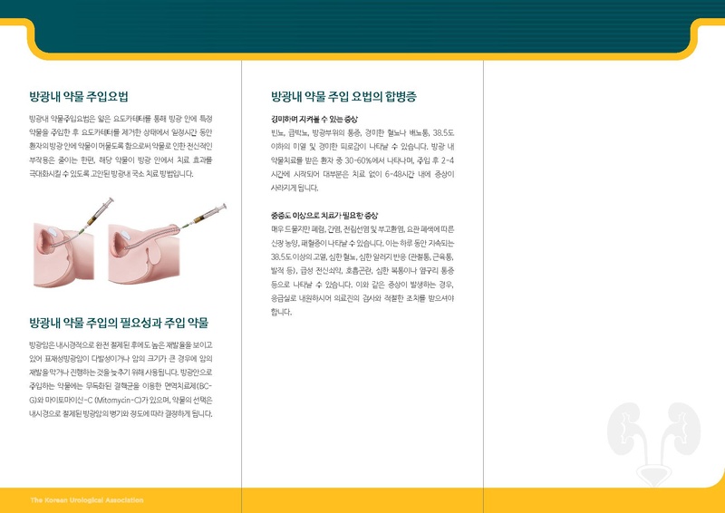 파일:방광내 약물 주입.pdf