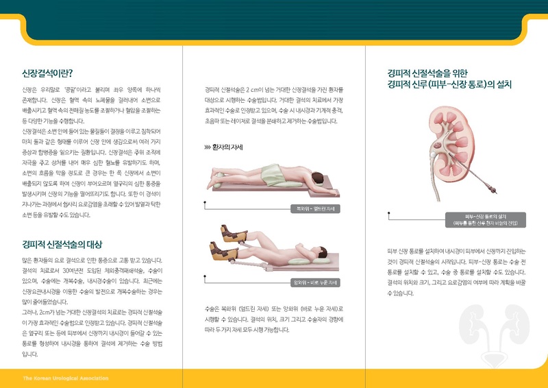 파일:경피적 신절석술.pdf