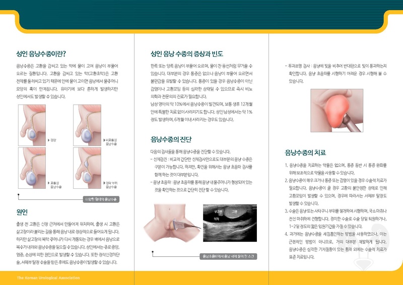 파일:성인 음낭 수종.pdf