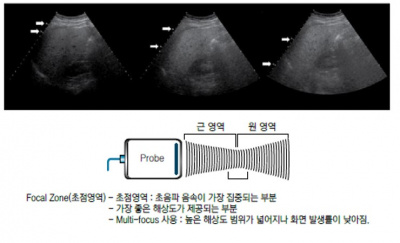 초음파 검사 장비의 기본구조 11.jpg