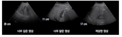초음파 검사 장비의 기본구조 10.jpg